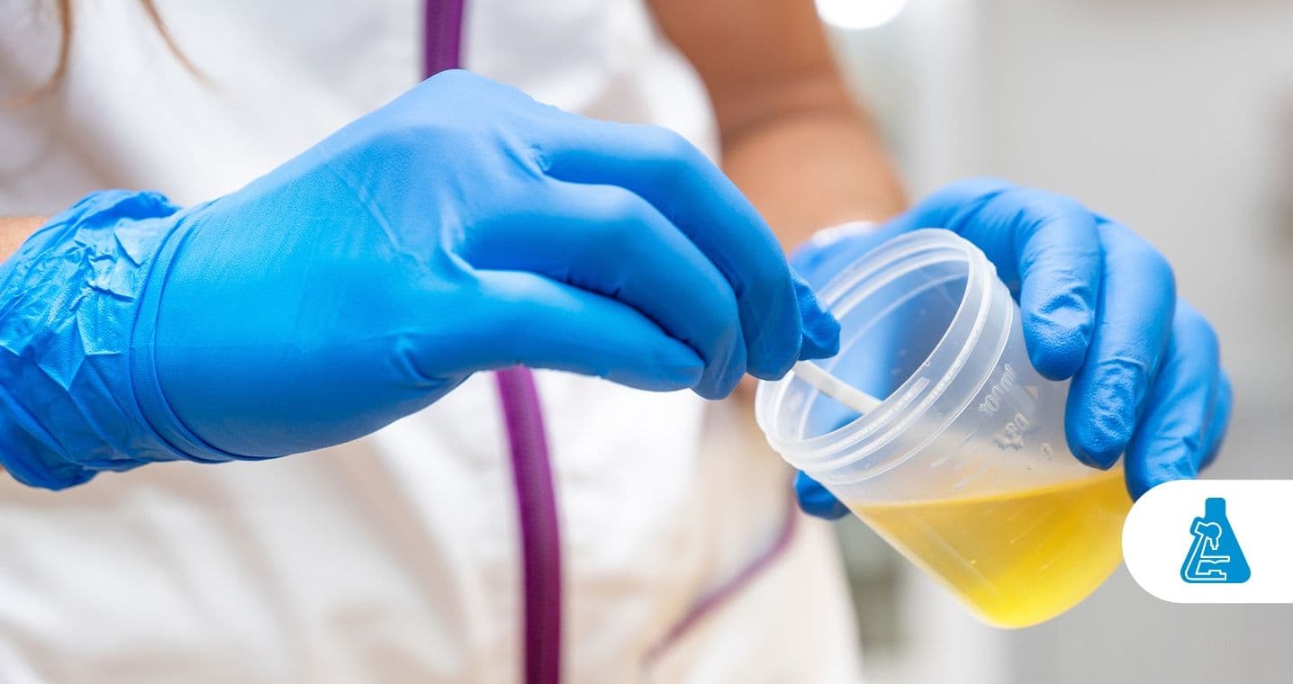 Como coletar fezes e urina para exames_ - 1436x760-compressed.jpg